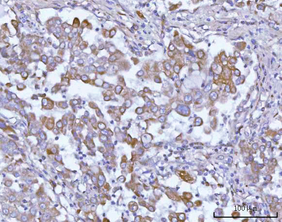 a10009 1 osgin1 primary antibodies ihc testing 3