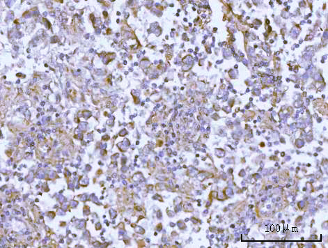 a10009 1 osgin1 primary antibodies ihc testing 4