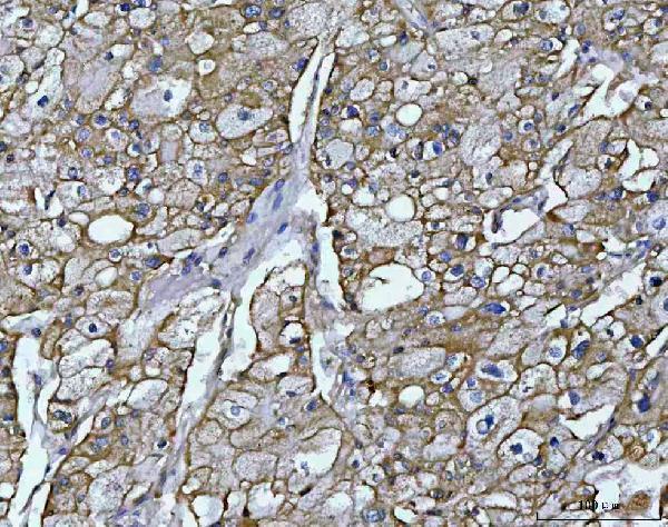 a10009 1 osgin1 primary antibodies ihc testing 5