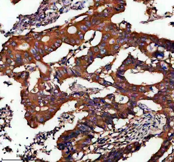 a10010 fam20b primary antibodies ihc testing 1
