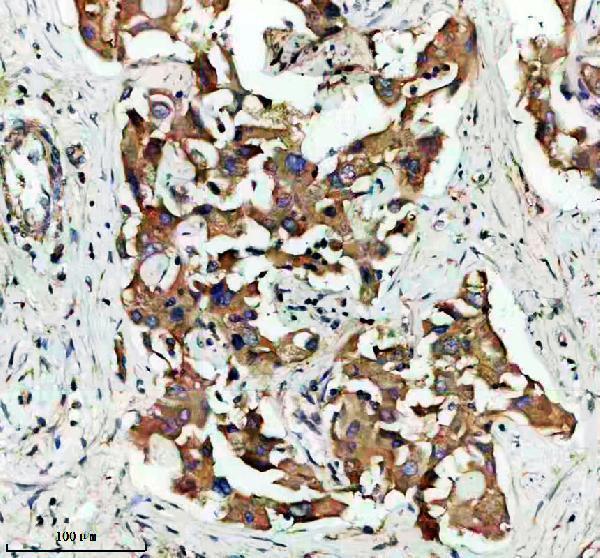 a10010 fam20b primary antibodies ihc testing 2