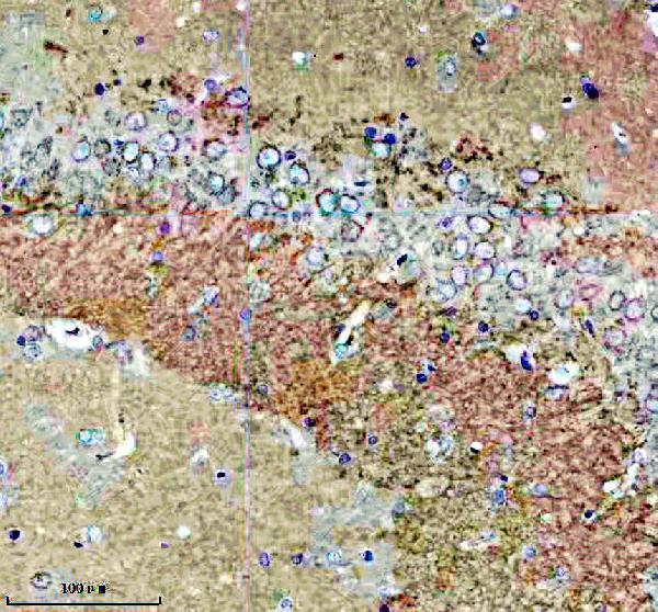a10010 fam20b primary antibodies ihc testing 3