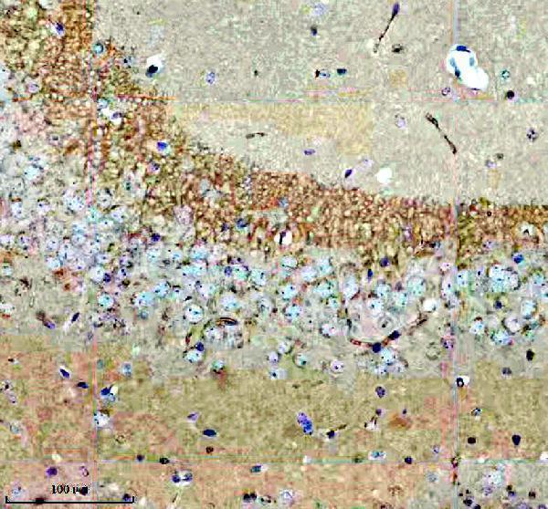 a10010 fam20b primary antibodies ihc testing 4