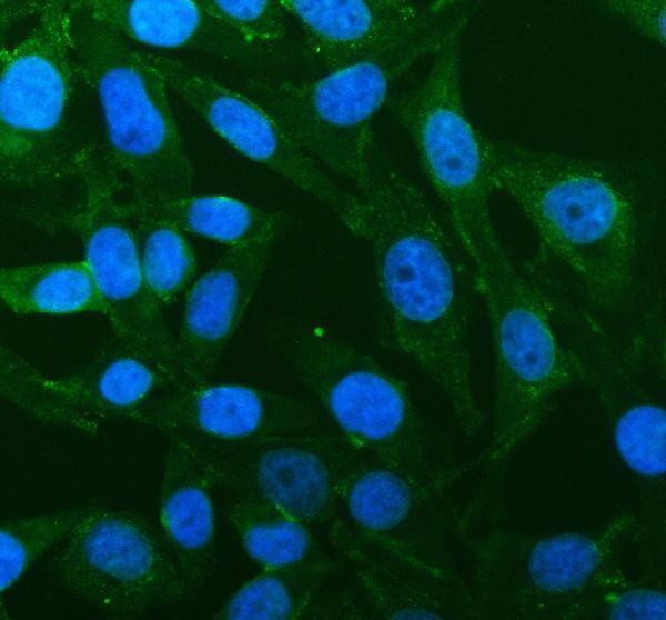 IF analysis of PGAM2 using anti-PGAM2 antibody (A10014-2)