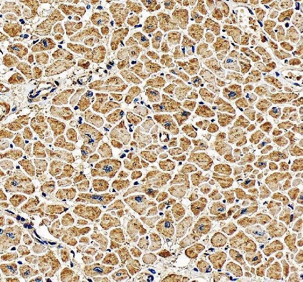 IHC analysis of PGAM2 using anti-PGAM2 antibody (A10014-2)