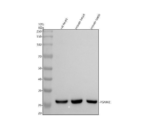 Western blot analysis of PGAM2 using anti-PGAM2 antibody (A10014-2)