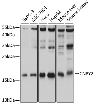 Western blot analysis of extracts of various cell lines, using CNPY2 antibody  at 1:1000 dilution