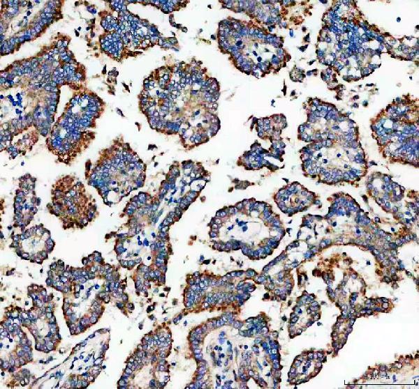 a10021 1 galnt7 primary antibodies ihc testing 1