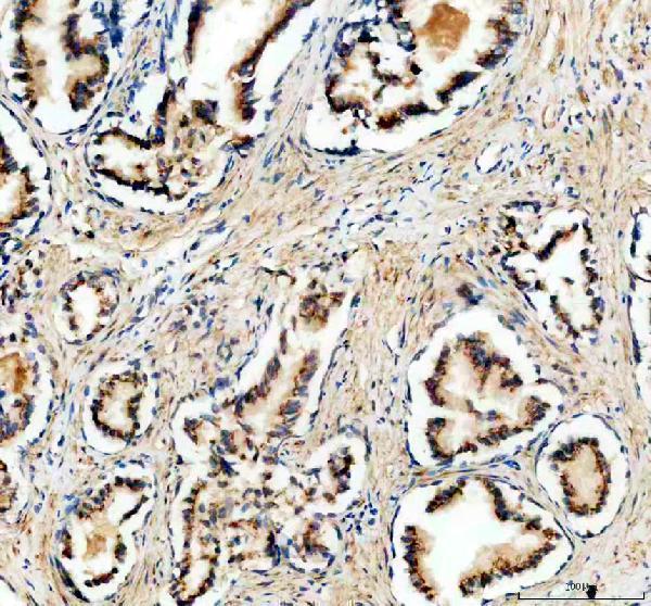 a10021 1 galnt7 primary antibodies ihc testing 2