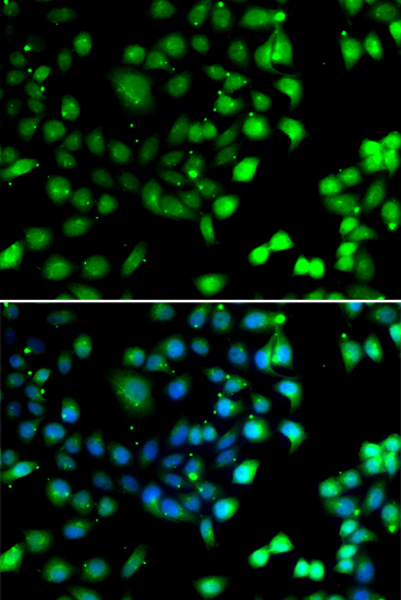 a10023 ntmt1 primary antiboties if testing 2