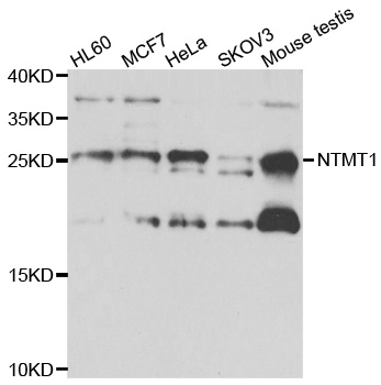 a10023 ntmt1 primary antiboties wb testing 1