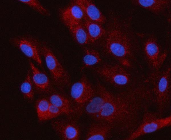Figure 2. IF analysis of HSD3B7 using anti-HSD3B7 antibody (A10025-1). HSD3B7 was detected in an immunocytochemical section of A549 cells. Enzyme antigen retrieval was performed using IHC enzyme antigen retrieval reagent (AR0022) for 15 mins. The cells were blocked with 10% goat serum. And then incubated with 5 microg/mL rabbit anti-HSD3B7 Antibody (A10025-1) overnight at 4°C. Cy3 Conjugated Goat Anti-Rabbit IgG (BA1032) was used as secondary antibody at 1:500 dilution and incubated for 30 minutes at 37°C. The section was counterstained with DAPI. Visualize using a fluorescence microscope and filter sets appropriate for the label used.