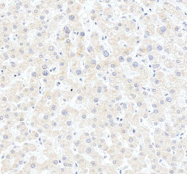 IHC analysis of HSD3B7 using anti-HSD3B7 antibody (A10025-1)