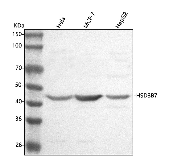 Figure 1. Western blot analysis of HSD3B7 using anti-HSD3B7 antibody (A10025-1). Electrophoresis was performed on a 5-20% SDS-PAGE gel at 70V (Stacking gel) / 90V (Resolving gel) for 2-3 hours. The sample well of each lane was loaded with 30 ug of sample under reducing conditions. Lane 1: human Hela whole cell lysates, Lane 2: human MCF-7 whole cell lysates, Lane 3: human HepG2 whole cell lysates. After electrophoresis, proteins were transferred to a nitrocellulose membrane at 150 mA for 50-90 minutes. Blocked the membrane with 5% non-fat milk/TBS for 1.5 hour at RT. The membrane was incubated with rabbit anti-HSD3B7 antigen affinity purified polyclonal antibody (Catalog # A10025-1) at 0.5 microg/mL overnight at 4°C, then washed with TBS-0.1%Tween 3 times with 5 minutes each and probed with a goat anti-rabbit IgG-HRP secondary antibody at a dilution of 1:5000 for 1.5 hour at RT. The signal is developed using an Enhanced Chemiluminescent detection (ECL) kit (Catalog # EK1002) with Tanon 5200 system. A specific band was detected for HSD3B7 at approximately 45 kDa. The expected band size for HSD3B7 is at 41 kDa.