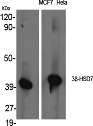 Western blotting validation for Anti-beta-HSD7 HSD3B7 Antibody A10025
Western Blot (WB) analysis of specific cells using 3beta-HSD7 polyclonal antibody