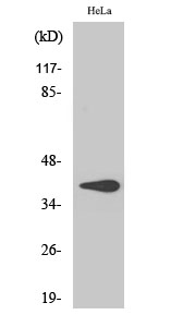 Western blotting validation for Anti-beta-HSD7 HSD3B7 Antibody A10025
Western Blot (WB) analysis of HeLa cells using 3beta-HSD7 polyclonal antibody