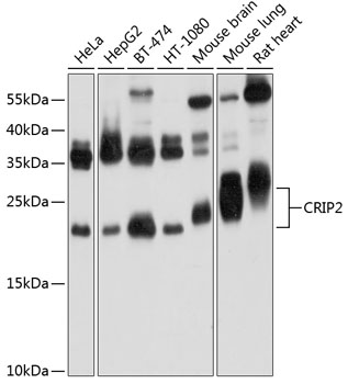 Western blot analysis of extracts of various cell lines, using CRIP2 Antibody  at 1:1000 dilution