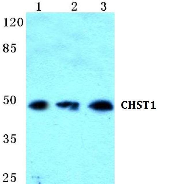 Western blot (WB) analysis of CHST1 polyclonal antibody at 1:500 dilution
Lane1:A549 cell lysate
Lane2:Raw264