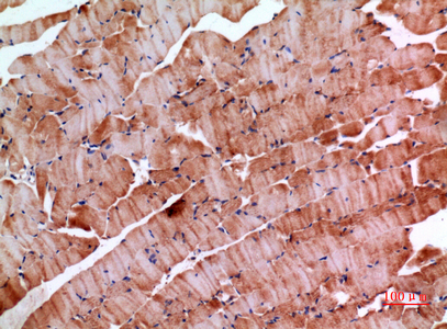 a10030 inhbe primary antibodies ihc testing 1