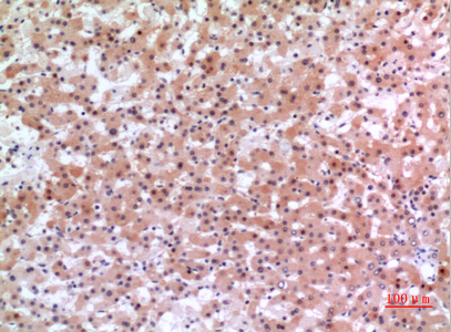 a10030 inhbe primary antibodies ihc testing 3