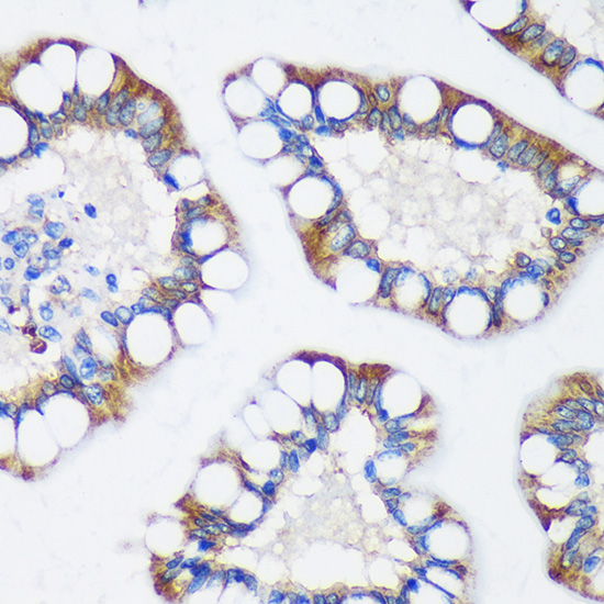a10036 trim62 primary antiboties ihc testing 2