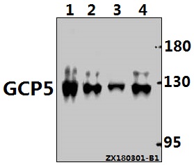 Western blot (WB) analysis of GCP5 (I779) pAb at 1:500 dilution
Lane1:HEK293T whole cell lysate(40ug)
Lane2:L02 whole cell lysate(40ug)
Lane3:SGC7901 whole cell lysate(20ug)
Lane4:A375 whole cell lysate(40ug)
