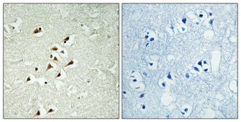 Immunohistochemical analysis of paraffin-embedded Human brain