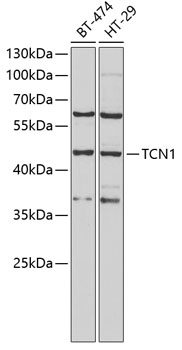 a10041 tcn1 primary antiboties wb testing 1