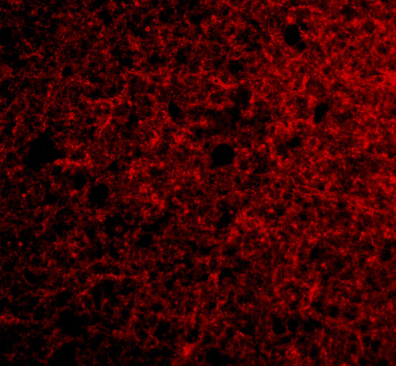a10045 prss12 primary antibodies if testing 3