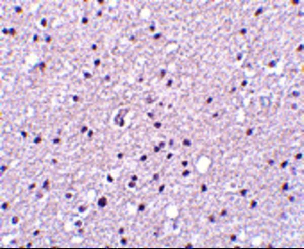 a10045 prss12 primary antibodies ihc testing 2