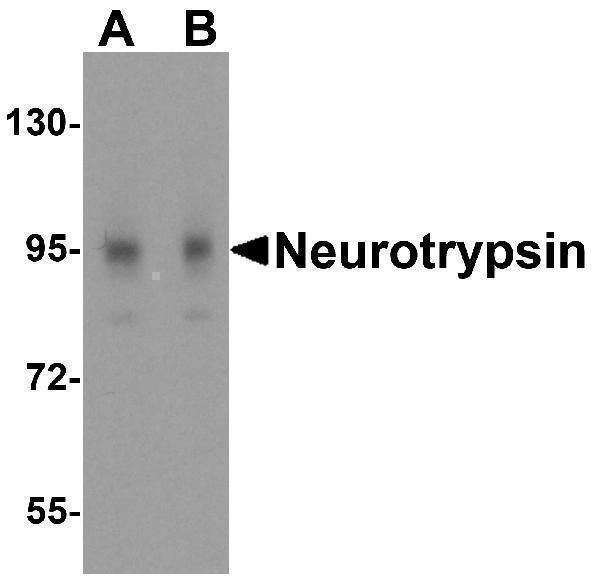 a10045 prss12 primary antibodies wb testing 1
