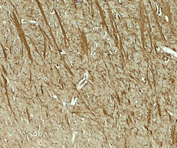 Immunohistochemistry of TENM3 in mouse brain tissue with TENM3 antibody at 5 μg/mL