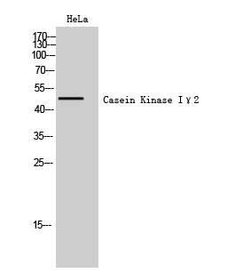 Western Blot analysis of HeLa cells using Casein Kinase Iγ2 Polyclonal Antibody