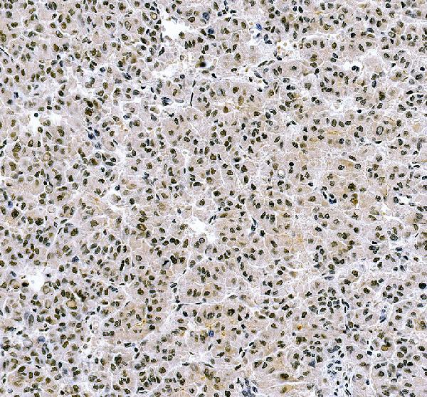 IHC analysis of DDX10 using anti-DDX10 antibody (A10055-1)
