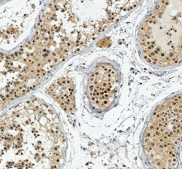 IHC analysis of DDX10 using anti-DDX10 antibody (A10055-1)