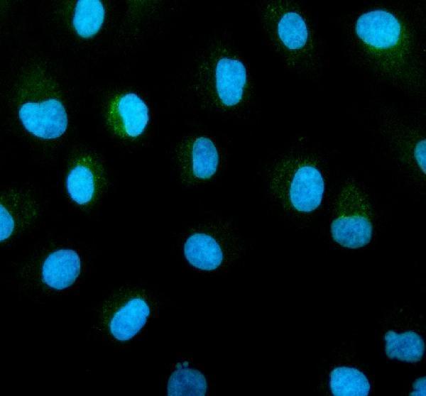 IF analysis of TIMM50 using anti-TIMM50 antibody (A10056-2)