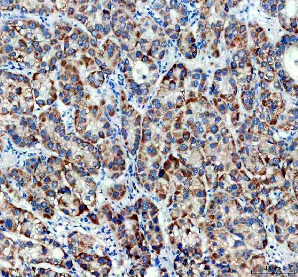 IHC analysis of TIMM50 using anti-TIMM50 antibody (A10056-2)