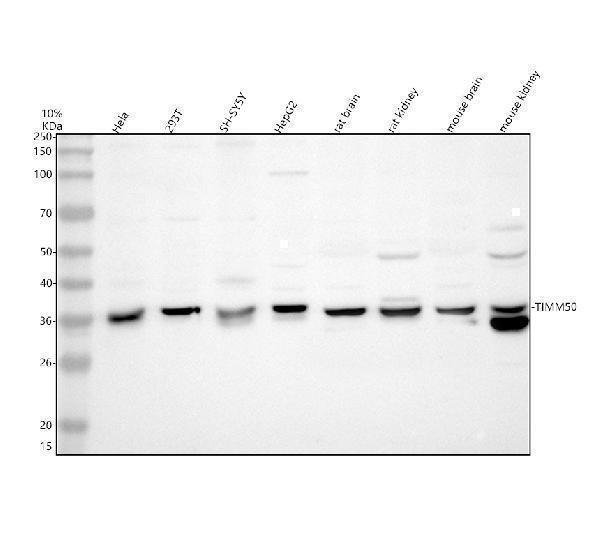 Western blot analysis of TIMM50 using anti-TIMM50 antibody (A10056-2)