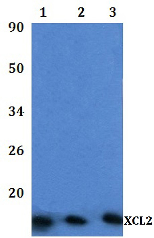 Western blot (WB) analysis of XCL2 polyclonal antibody at 1:500 dilution  Lane1:HEK293T whole cell lysate
Lane2:RAW264