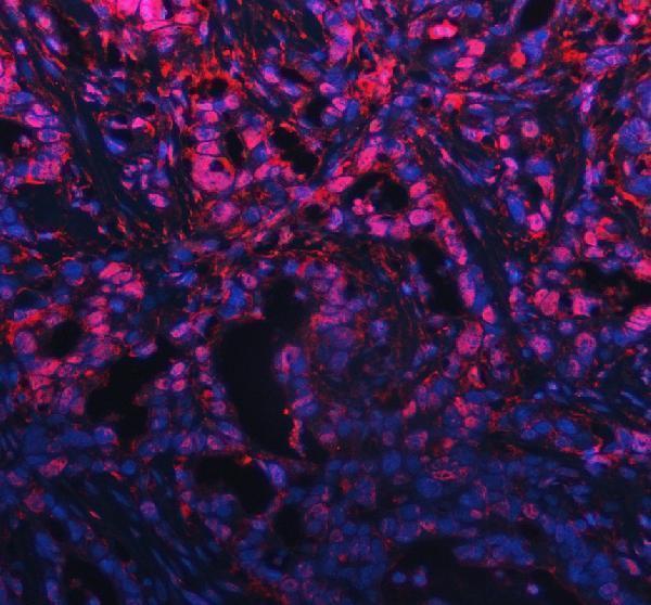 a10060 phf5a primary antibodies if testing 1