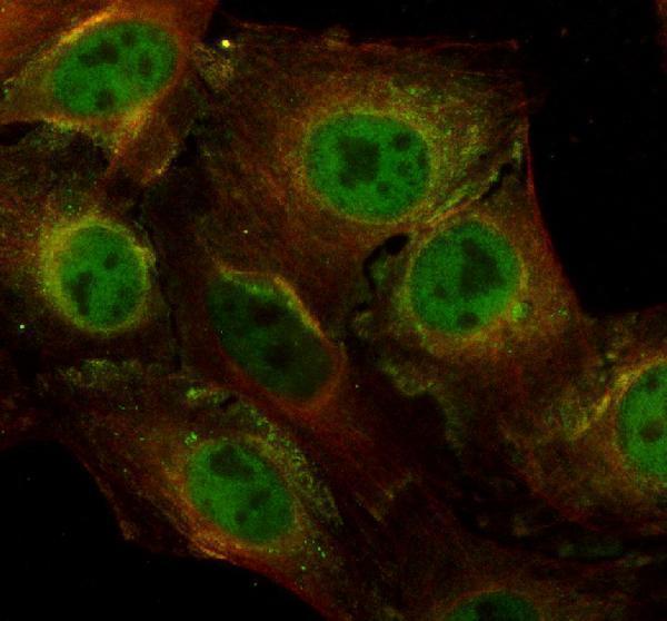 a10060 phf5a primary antibodies if testing 2