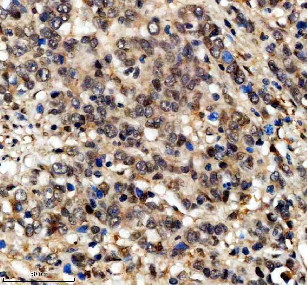 a10060 phf5a primary antibodies ihc testing 1