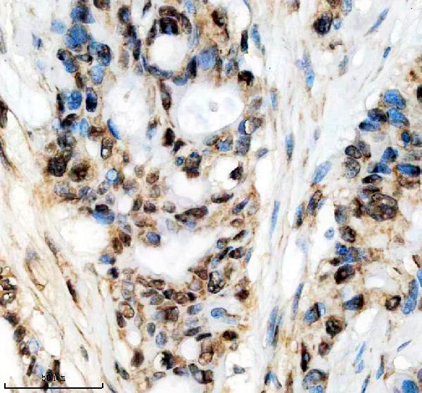 a10060 phf5a primary antibodies ihc testing 2