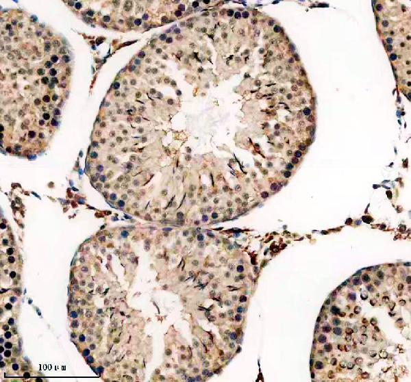 a10060 phf5a primary antibodies ihc testing 3