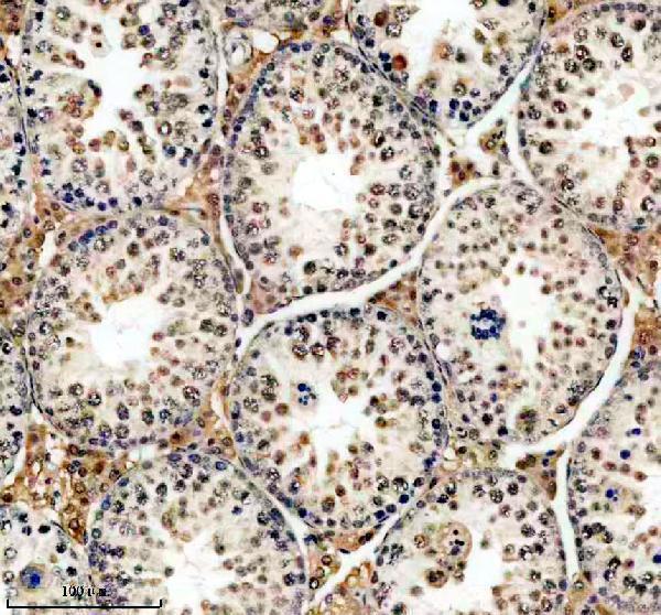 a10060 phf5a primary antibodies ihc testing 4
