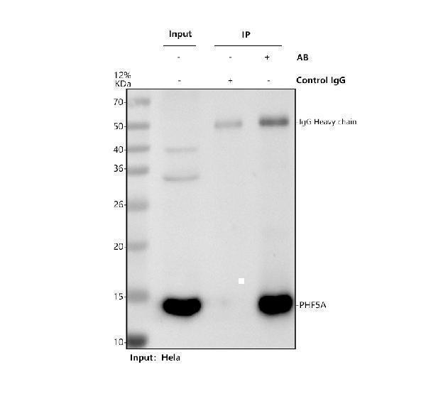 a10060 phf5a primary antibodies ip testing 1