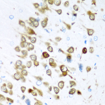 a10061 elavl3 primary antiboties ihc testing 2