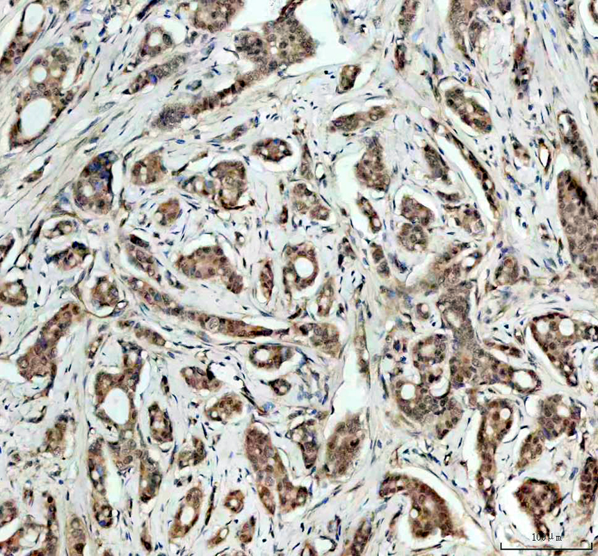 IHC analysis of P15RS/RPRD1A using anti-P15RS/RPRD1A antibody (A10062-1)