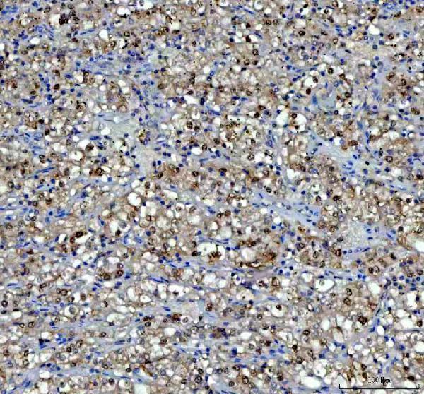 a10062 1 rprd1a primary antibodies ihc testing 2