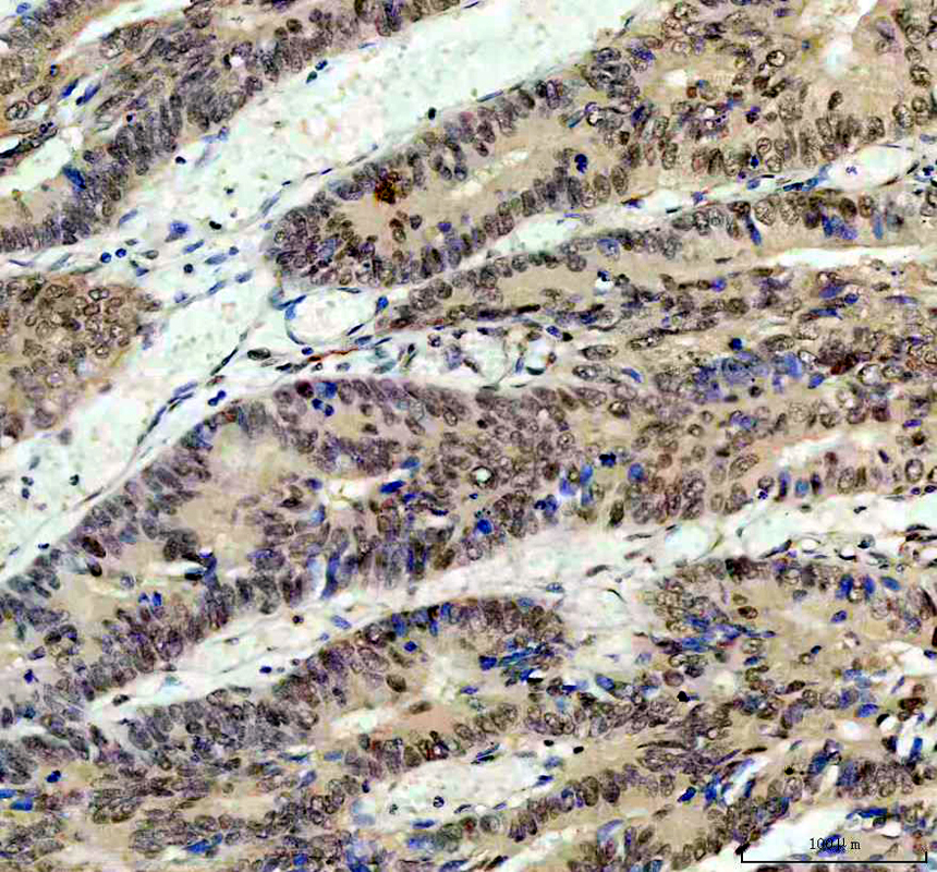 IHC analysis of P15RS/RPRD1A using anti-P15RS/RPRD1A antibody (A10062-1)